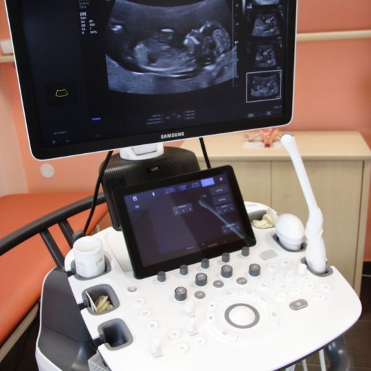 Ultrazvuk Samsung HS60 gynekologická ambulancia EMIMED