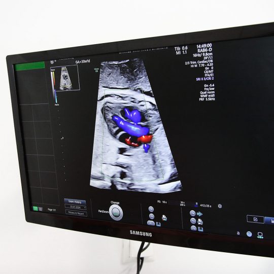 Gynekologická ambulancia EMIMED USG dopplerovské vyšetrenie